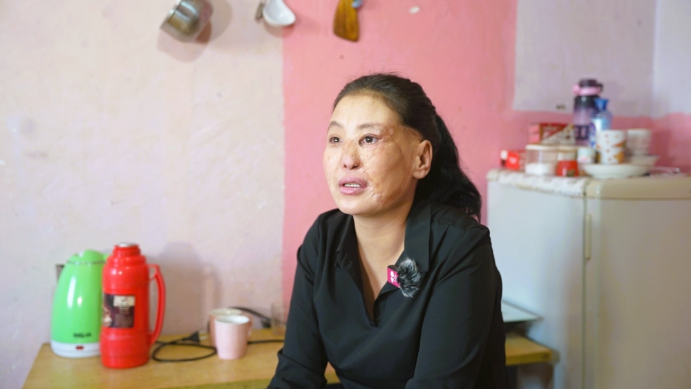 Н.Эрдэнэтуяа: Өөртэйгөө ижил нийгэмд гадуурхагдсан хүмүүст тусална